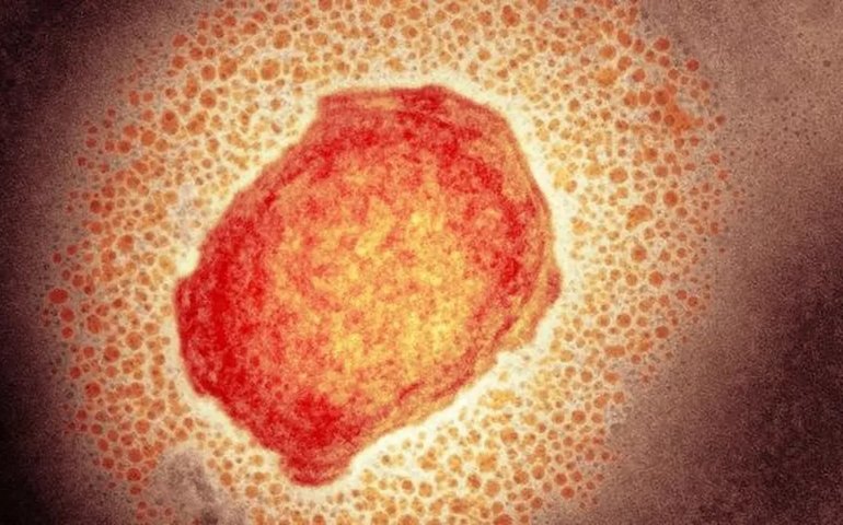 Sesau informa panorama dos casos suspeitos de Monkeypox em Alagoas