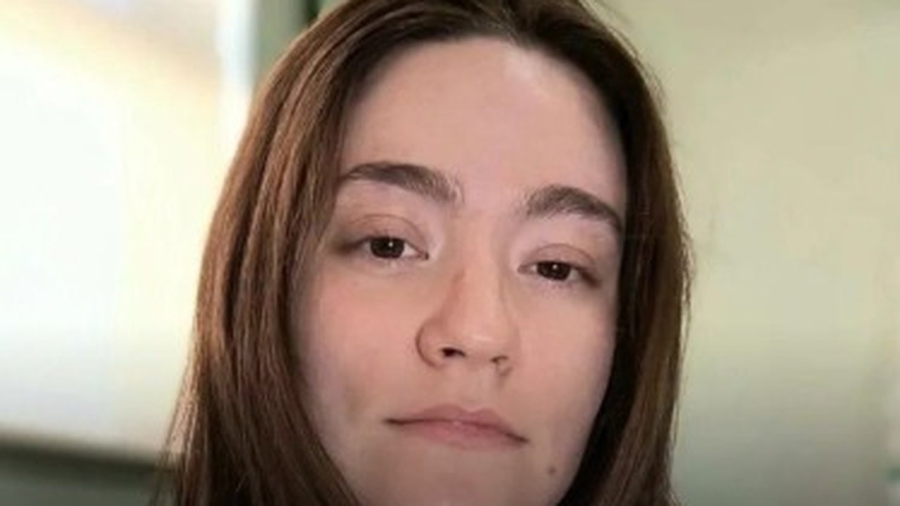 Mulher com a 'pior dor do mundo' se forma em medicina veterinária