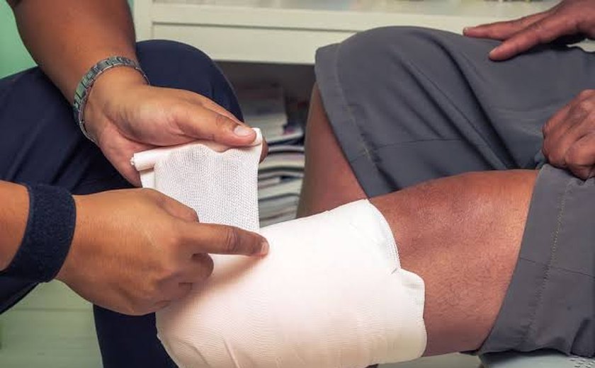 A cada hora, 3 brasileiros sofrem amputação de pernas ou pés