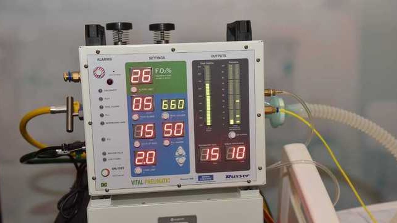 Brasil vai produzir ventilador pulmonar desenvolvido pela Nasa