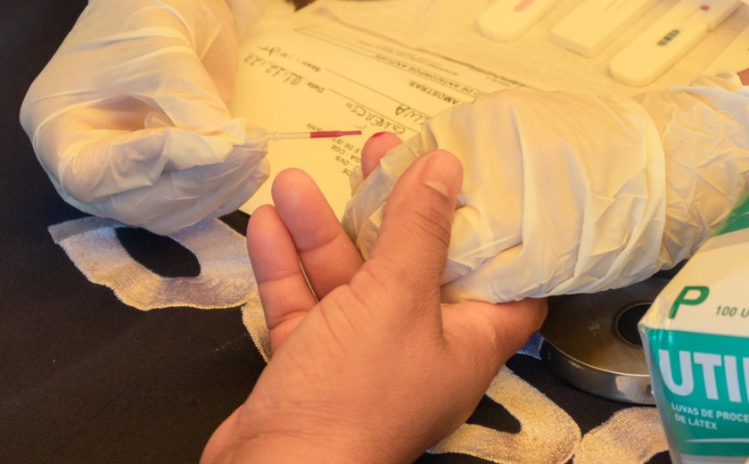 Saúde abre inscrições para oficina sobre aconselhamento, prevenção combinada e teste rápido