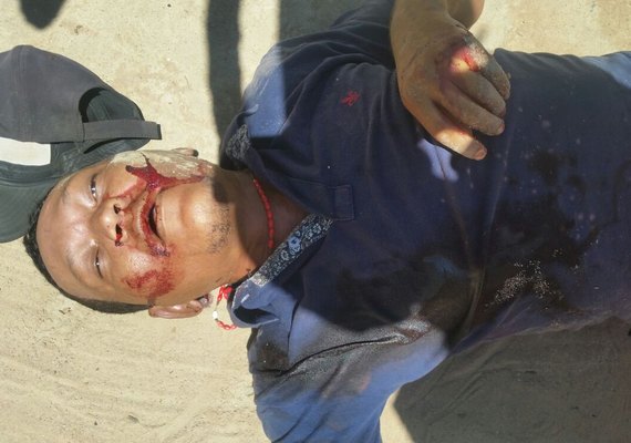 Homem é perseguido e assassinado em Palmeira