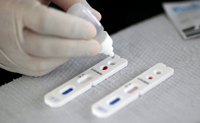 Farmácias brasileiras promoveram 19.067.187 testes rápidos desde abril de 2020
