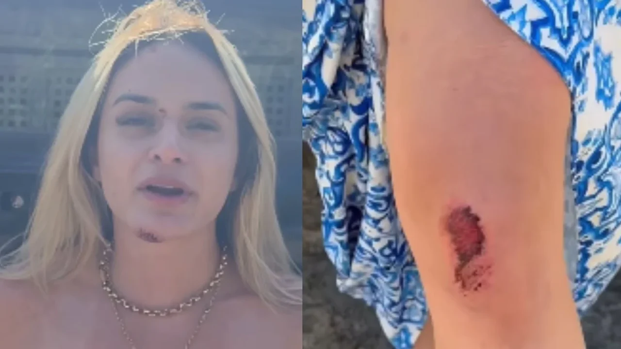 Suspeito de arrastar influencer em Maceió foge para Pernambuco e segue livre após decisão da Justiça