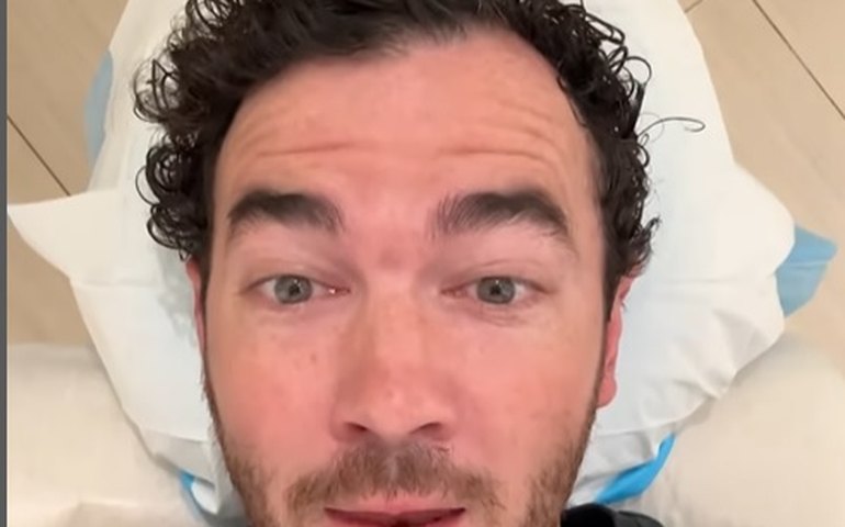 Kevin Jonas revela procedimento cirúrgico para retirada de um câncer de pele
