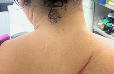 Homem é preso em flagrante por agressão à ex-companheira e filha de 8 anos em Arapiraca