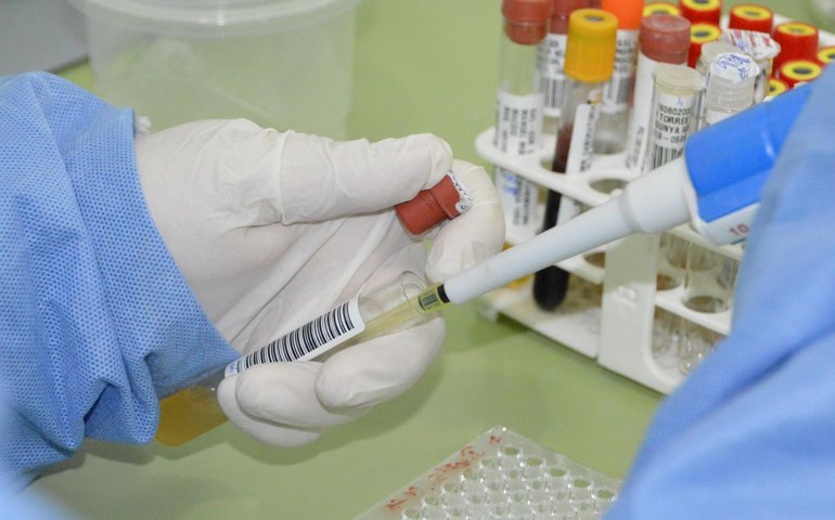 Sesau orienta população sobre riscos, prevenção e tratamento da doença de Chagas