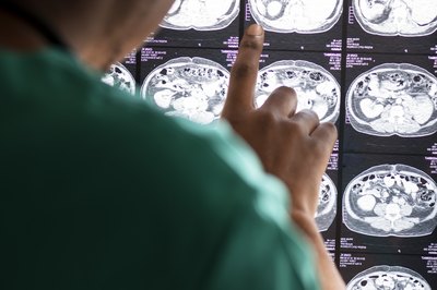 Santa Casa de Maceió abre seleção para aperfeiçoamento em tomografia e ressonância magnética