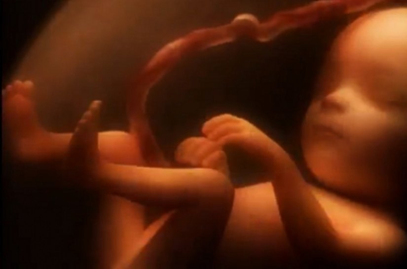 Especialista orienta gravidas para evitar possíveis doenças na gravidez