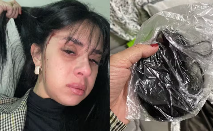 Cantora teve parte do cabelo cortado pelos agressores; caso é investigado pela Polícia Civil de SC