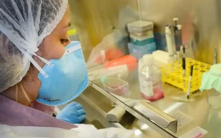 'Doença do beijo' pode estar por trás do mistério do lúpus, revela nova pesquisa