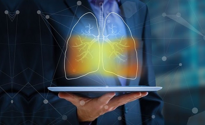Estudos trazem bons resultados de novas classes de medicamentos para o tratamento de câncer de pulmão avançado Estudos trazem bons resultados de novas classes de medicamentos para o tratamento de câncer de pulmão avançado