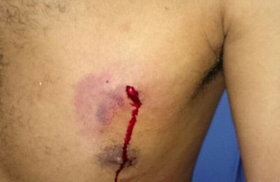 Atentado à bala deixa três feridos em Maceió