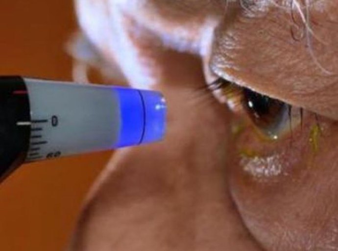 Clínicas devem manter tratamento de glaucoma em Maceió, cobra SMS