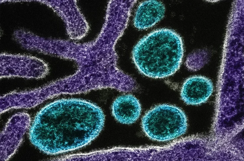 OMS considera baixo risco de disseminação do vírus Nipah além da Índia