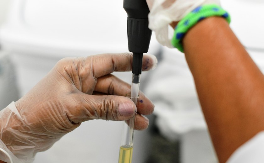 Hemocentro de Alagoas é referência na realização de exames para o diagnóstico de leucemia