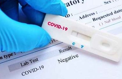 Boletim Epidemiológico desta quinta-feira (20) informa 1045 casos confirmados de Covid-19 em Penedo