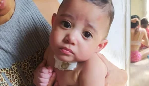 Richard Gabriel tinha 11 meses e microcefalia; mãe relata que o bebê morreu no dia seguinte à troca de uma sonda no HGE. - Foto: Arquivo pessoal