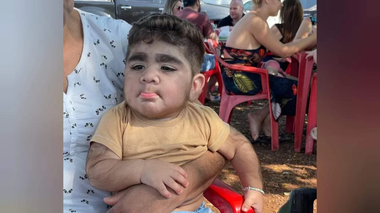 Bebê brasileiro que nasceu com barba viraliza no TikTok; veja vídeos