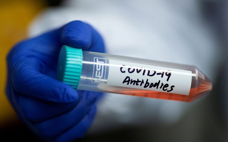 Saúde: Brasil registra 561 mortes por covid-19 em 24h; total é 94.665