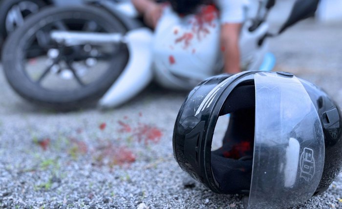 A motocicleta é uma das principais causas de traumas graves no trânsito A motocicleta é uma das principais causas de traumas graves no trânsito