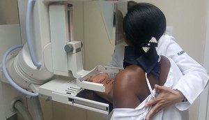mamografia-exame-mama-05022019144124753.jpeg / Foto: R7.com