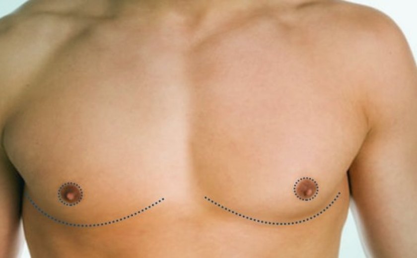 Cirurgias plásticas que transformam vidas e autoestima