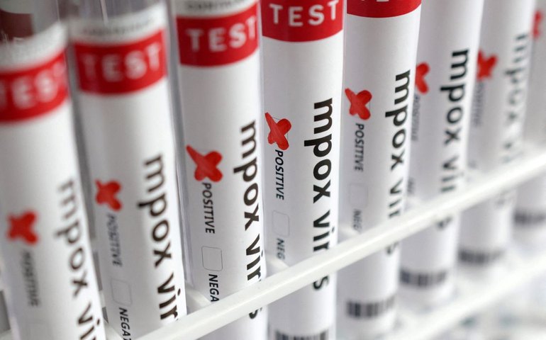 Anvisa renova dispensa de registro de duas vacinas contra mpox