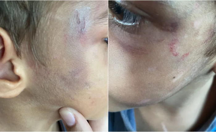Menino foi encaminhado ao IML para exame de corpo de delito
