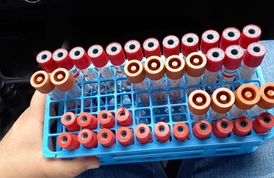 Adeal inicia coleta de amostras para identificar influenza aviária e doença de Newcastle