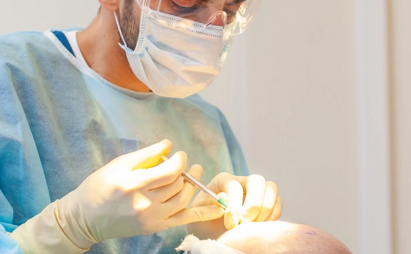 ABCRC dá orientações após transplante capilar no verão