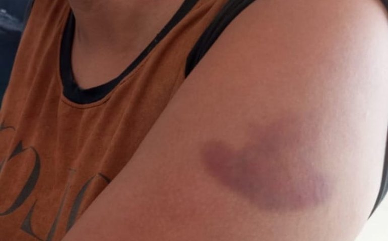 Homem é preso em Campo Alegre após agredir companheira com socos na cabeça