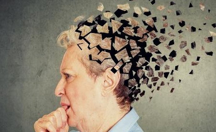 Alzheimer