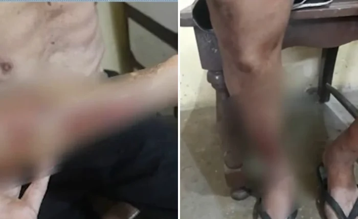 Idoso foi encontrado ferido pelo neto na manhã de segunda-feira, 7