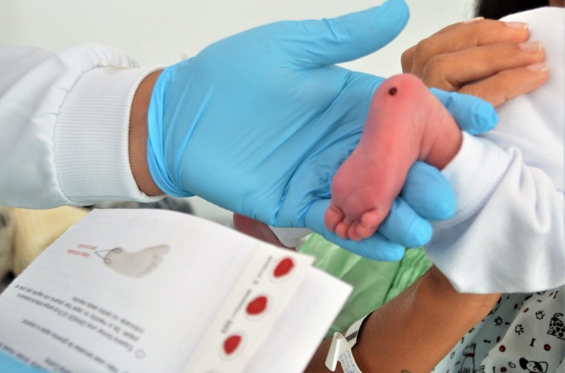 Pediatra da Sesau ressalta importância do Teste do Pezinho para diagnosticar sete doenças