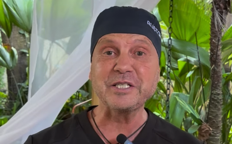 Cirurgião plástico de famosos avalia calvície do príncipe William e aponta possibilidade de transplante capilar