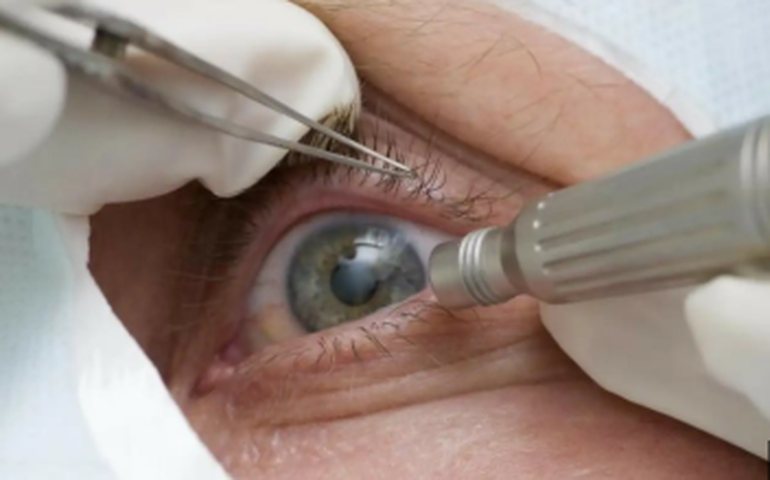 Todo mundo pode usar lente de contato colorida? Médico alerta para riscos do acessório, comum no Halloween