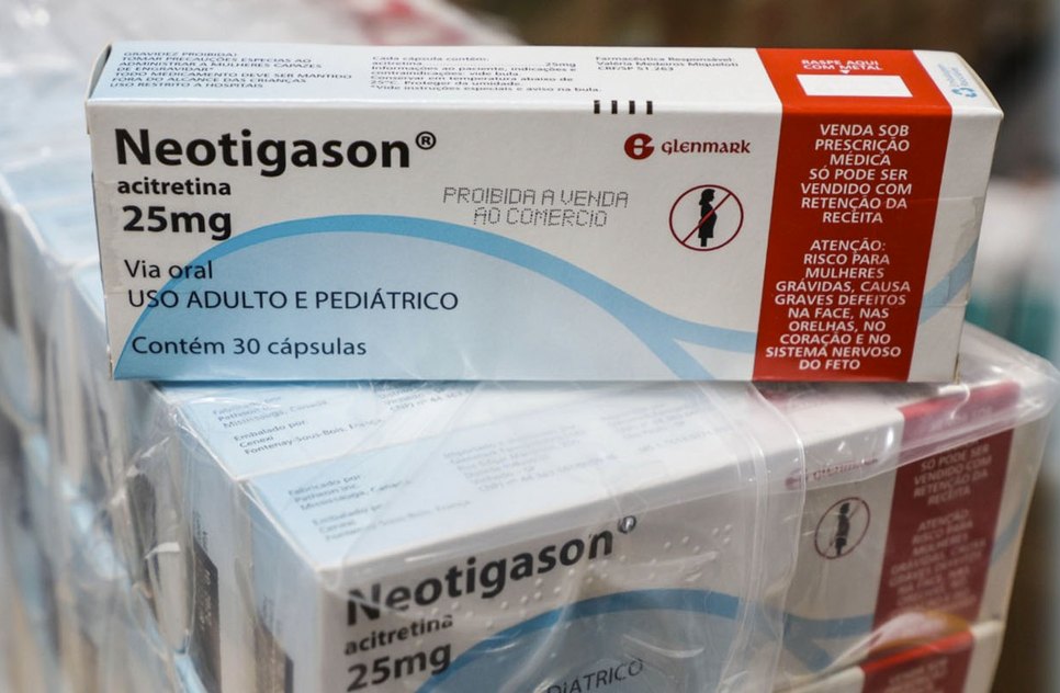 psoríase