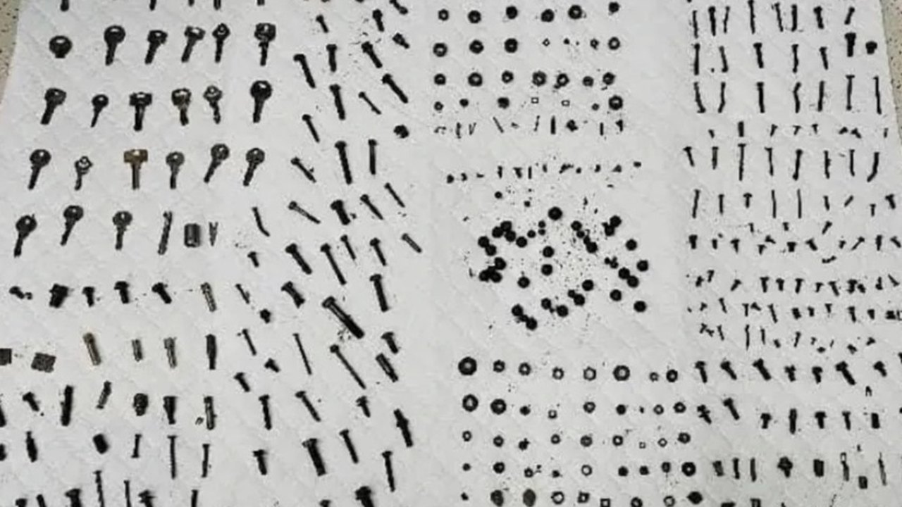 Médicos no Irã removem 452 objetos de metal do estômago de homem