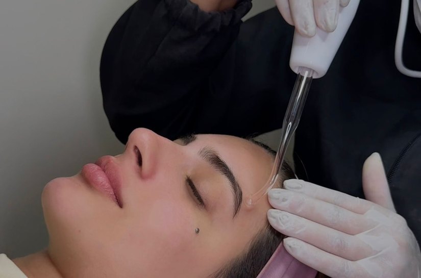 Tecnologia e cuidado: tratamentos faciais avançados ganham espaço no verão