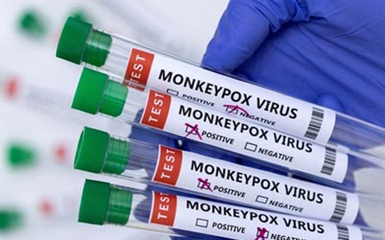 Estado de São Paulo concentra mais da metade dos casos de mpox no Brasil
