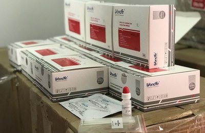 Prefeitura de Arapiraca adquire 10 mil testes rápidos para diagnóstico de Covid-19