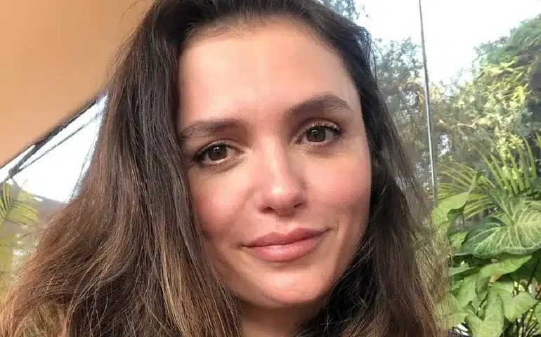 Modelo ex-candidata a Miss Venezuela morre após complicações em procedimento estético no rosto