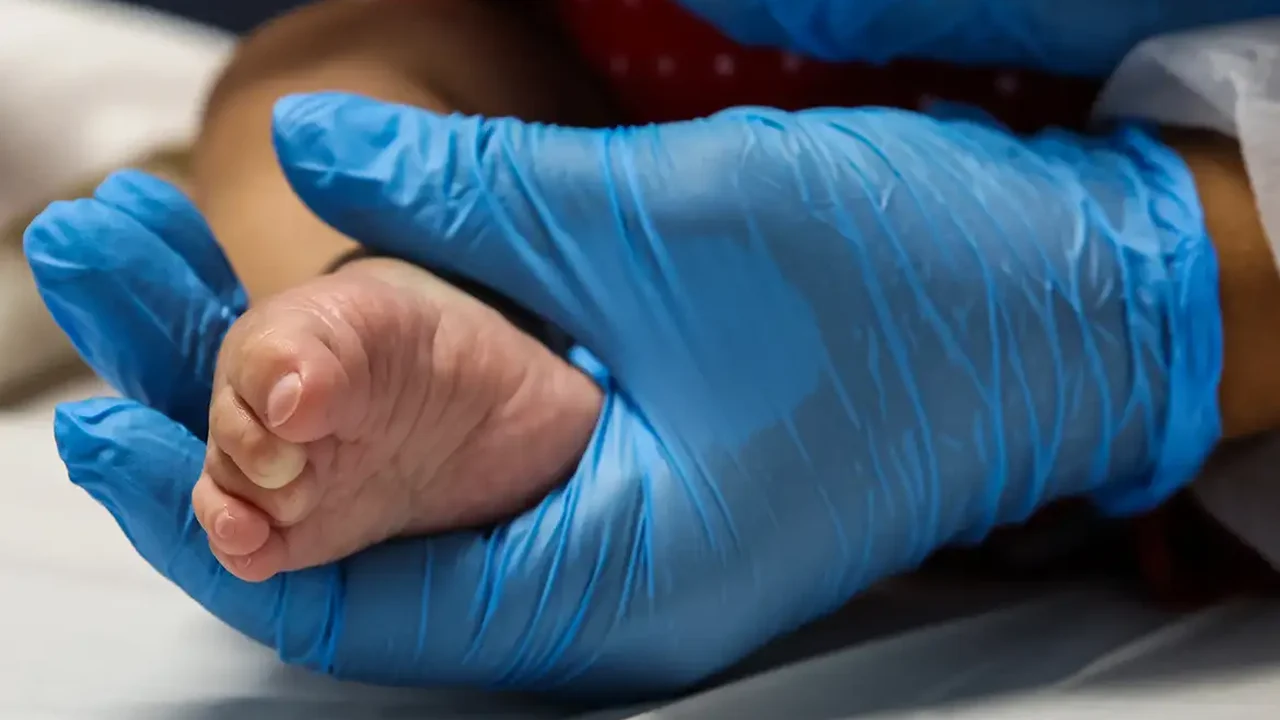 SUS vai ofertar remédio de alto custo para Atrofia Muscular Espinhal