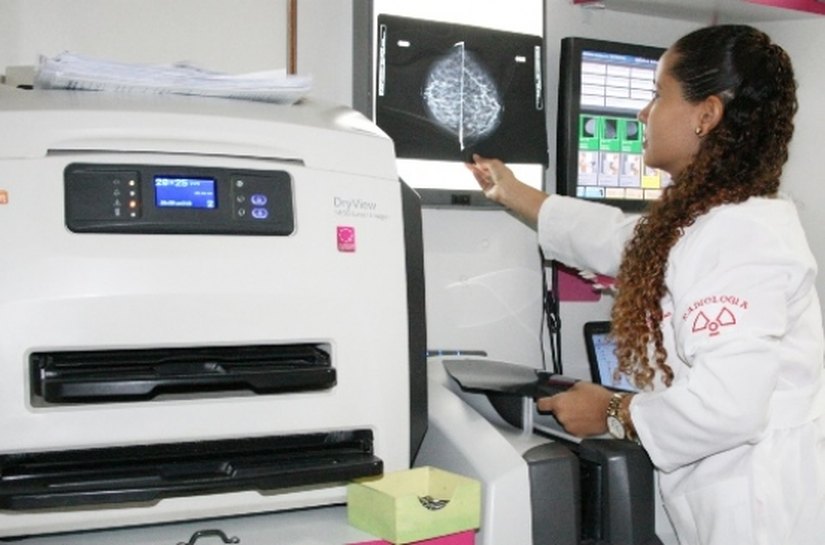 Saúde lança primeiro Plano Estadual de Oncologia na sexta-feira (17)