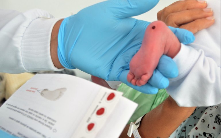 Teste do Pezinho está disponível pelo SUS nos 102 municípios alagoanos
