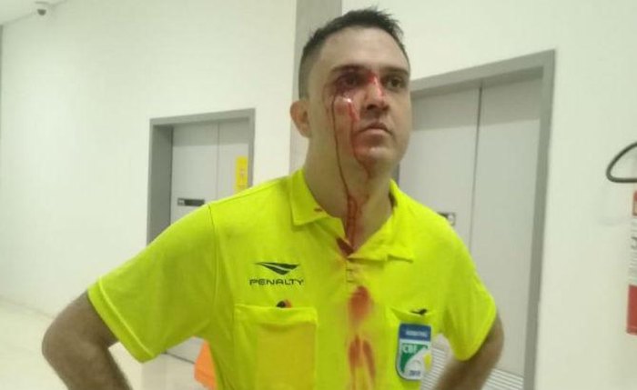 Tiago Nascimento diz ter sido agredido por torcedores - Foto: Divulgação