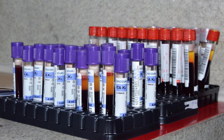 Vírus HTLV: saiba como se prevenir, diagnosticar e tratar pelo SUS