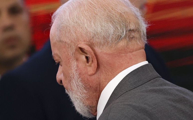 Lula repete exames de imagem da cabeça e quadro é estável