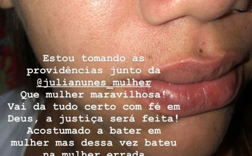 Mulher relata briga e agressão sofrida a caminho festa junina